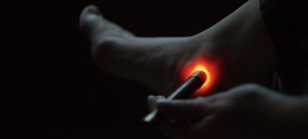  Photobiomodulation (PBM) 